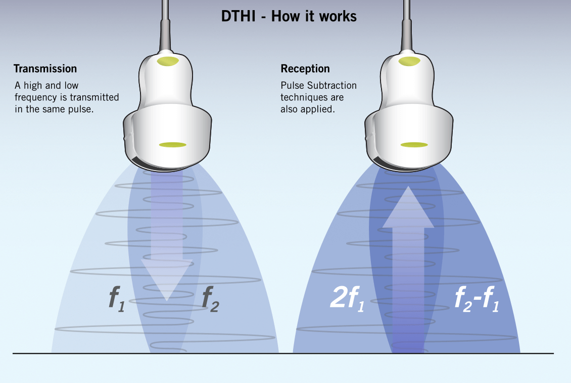 DTHI-Illustration-1130x759